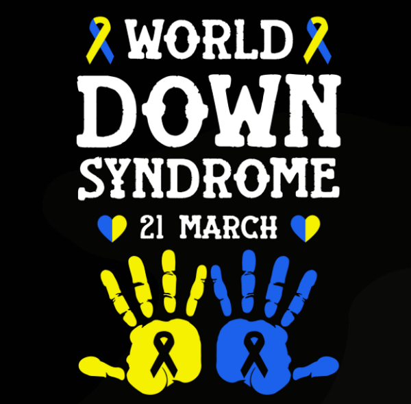 Down Syndrome 21
