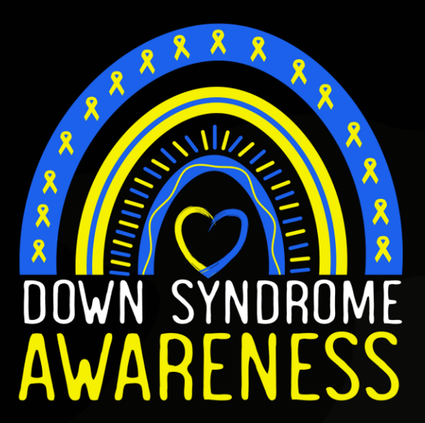 Down Syndrome 25