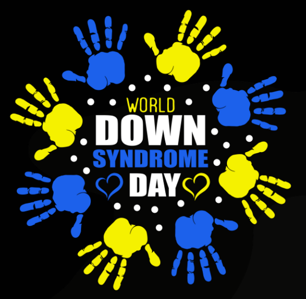 Down Syndrome 27
