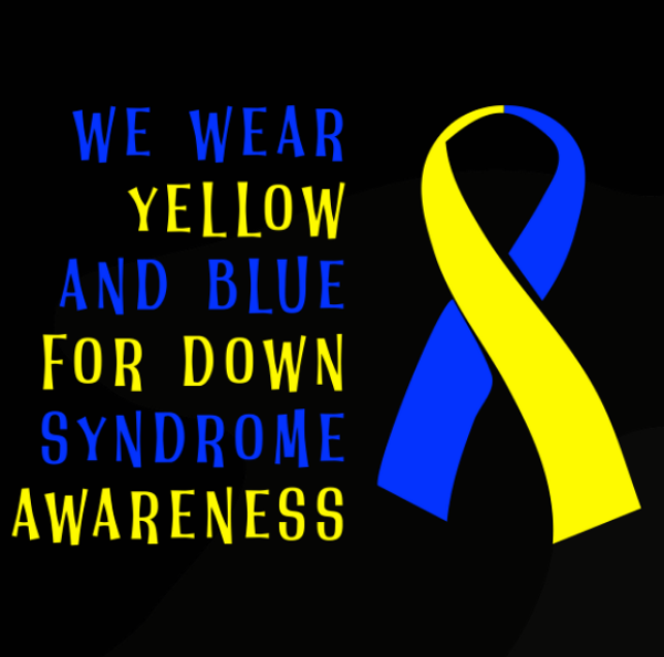Down Syndrome 47