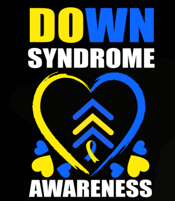 Down Syndrome 54