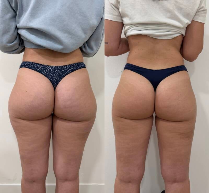 Mini lipo Cartucheras 