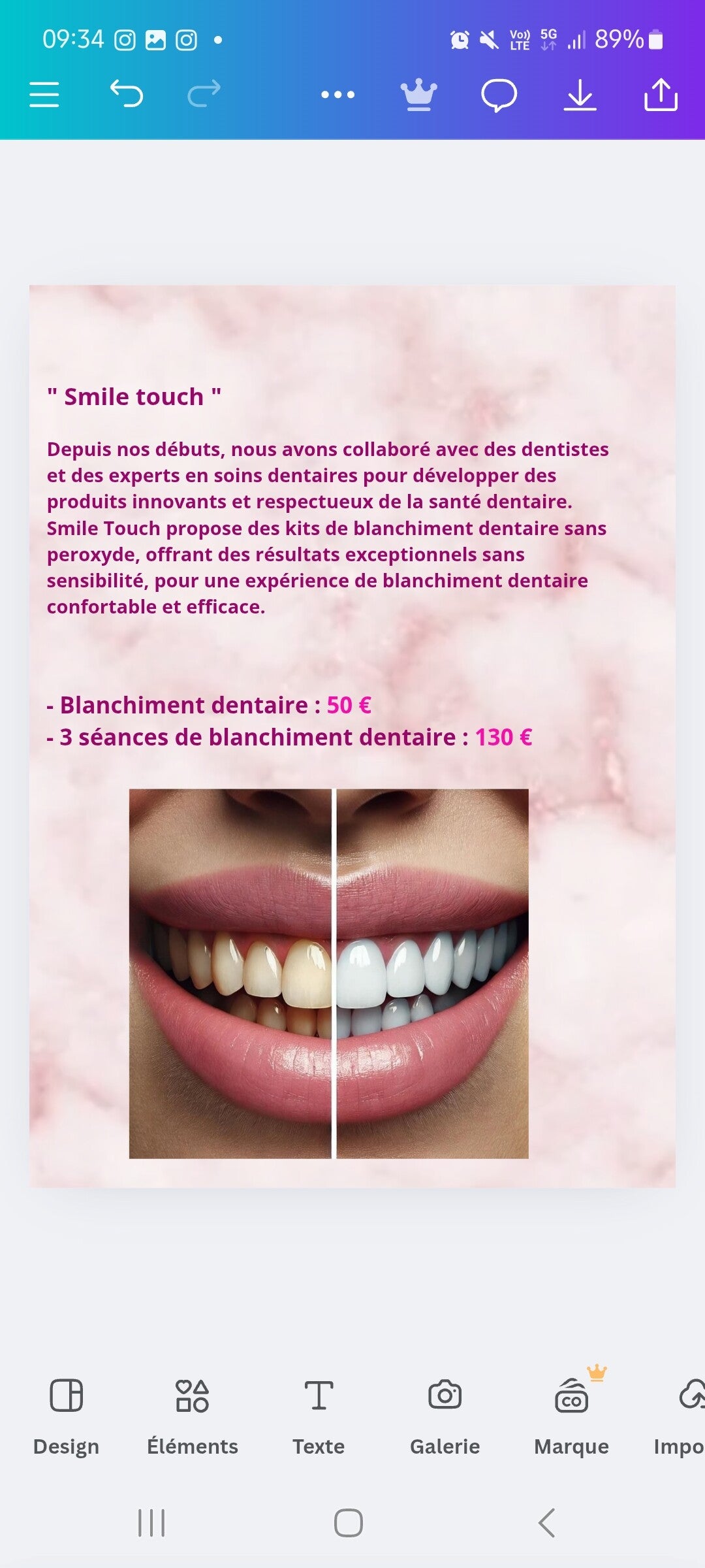 #blanchimentdentaire #dents #strassdentaire