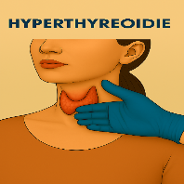 Hyperthyreoïdie
