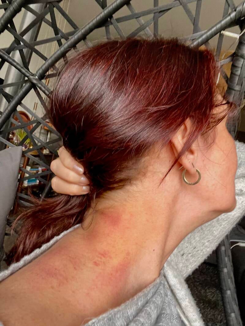 Cupping, lichaamsgerichte therapie, Balanzeren, Zwolle