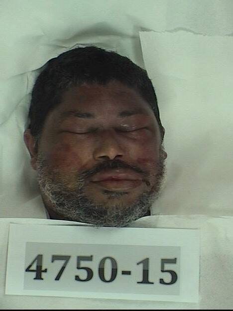 John D, Puerto Rico hospital Oct. 2015