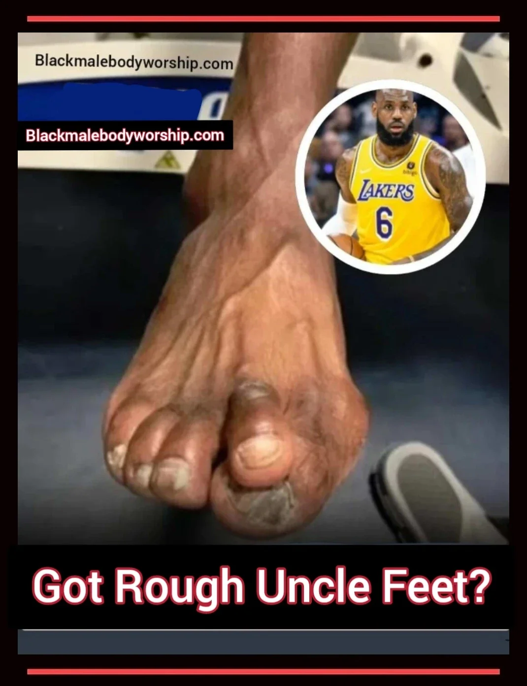 Viral feet of basketball player LeBron James—damaged, rough ‘uncle’ feet from 22 years of playing basketball, showing up-close damage with discolored toenails and crooked, damaged toes.