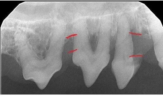 Dog dental radiographs x-rays taken under anesthesia showing how underlying disease causes bone loss requiring tooth extractions.