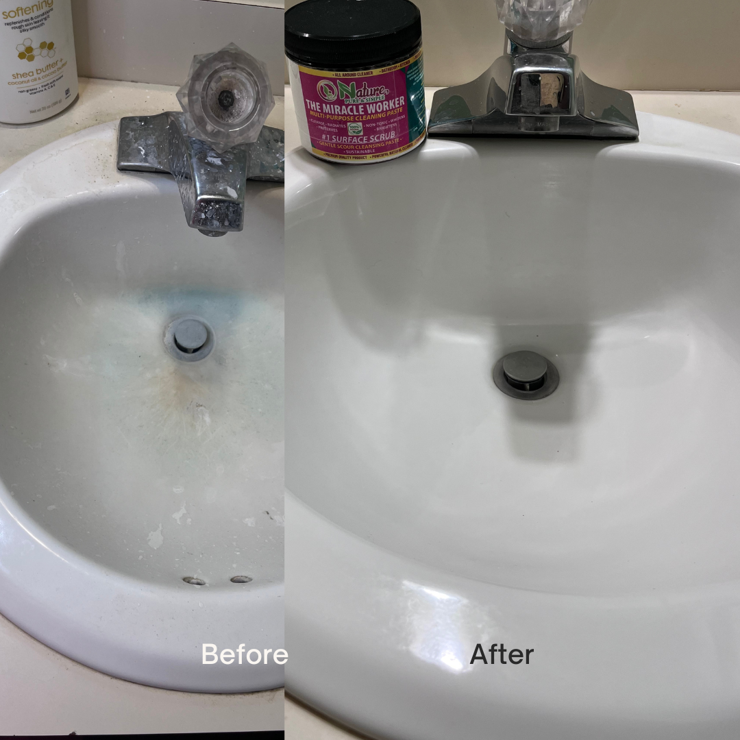 beige-minimalist-skincare-before-and-after-instagram-post-1-standard.png