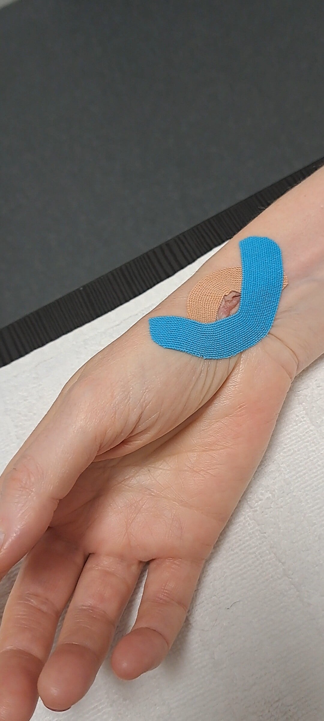 kinesiotaping scar
