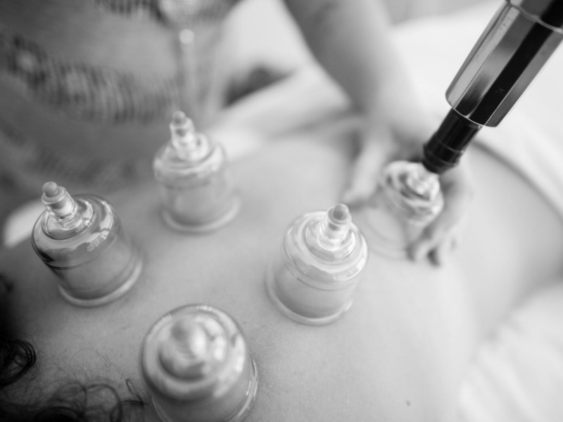 Cupping behandeling