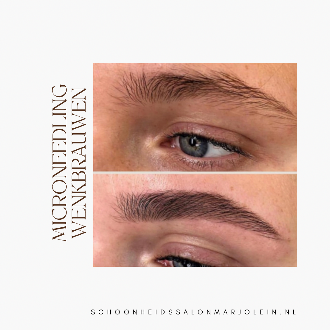 Stamceltechniek  Gouda