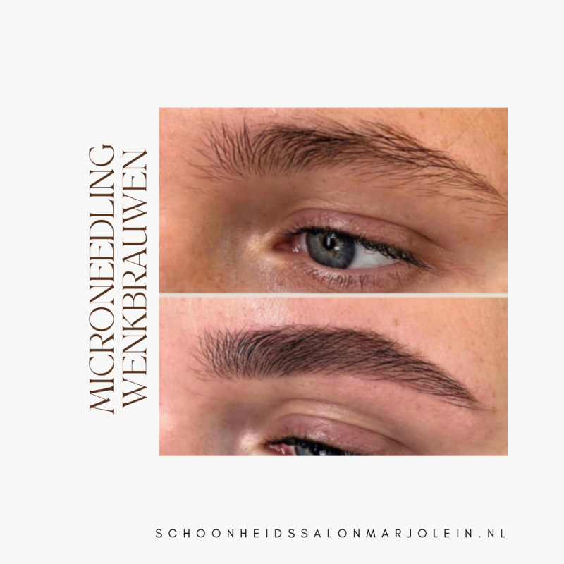 Microneedling wenkbrauwen 