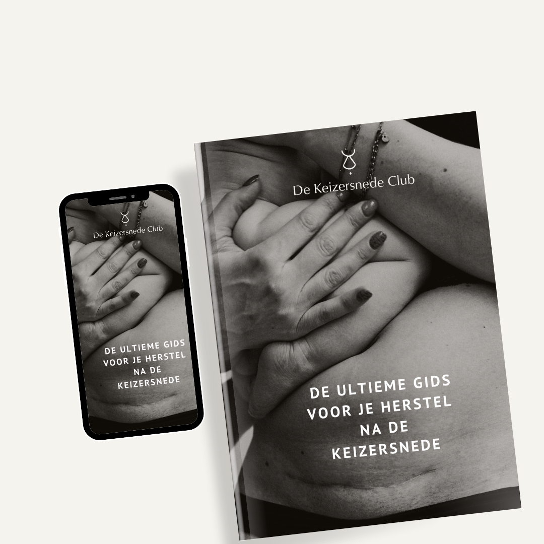 De ultieme gids voor herstel na de keizersnede (De Keizersnede Club)
