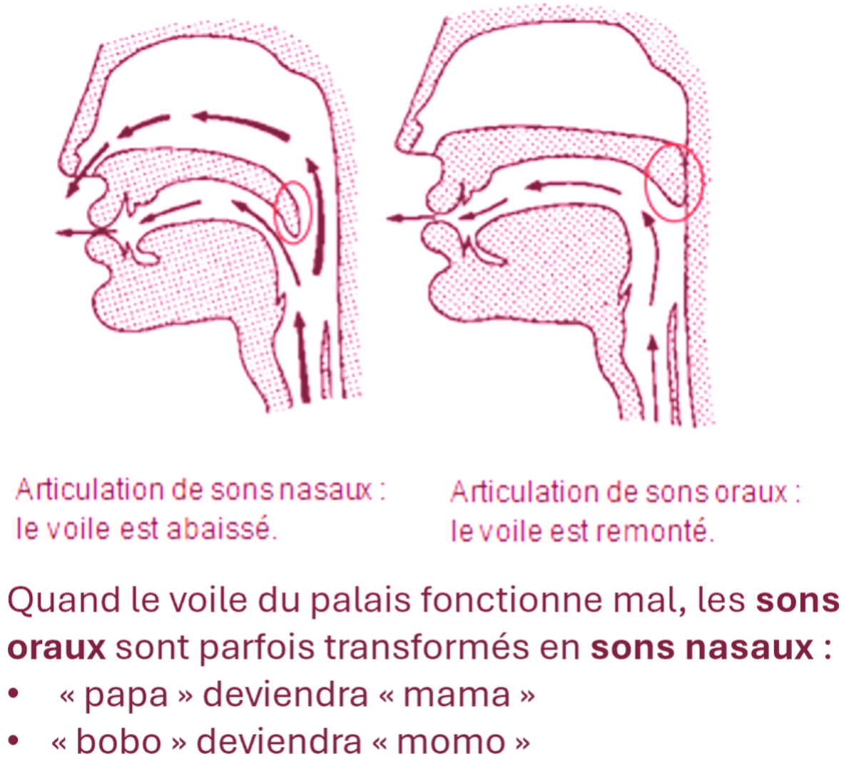 La chirurgie de la fente du voile du palais s’effectue entre 3 et 12 mois ; le palais osseux est refermé ultérieurement, entre 10 et 18 mois.  Une surveillance de la parole et de la croissance de la mâchoire est indispensable.  Si l'insuffisance vélaire, 