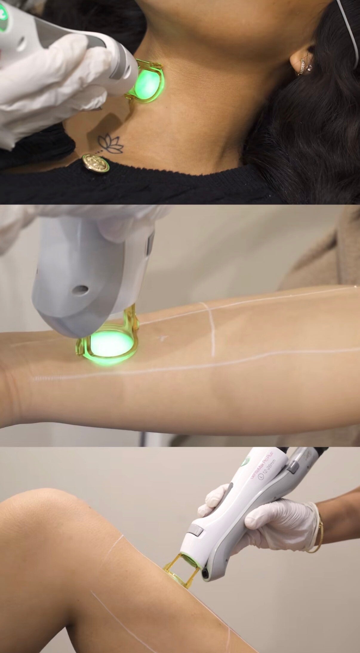 Stel je eigen laser pakket samen