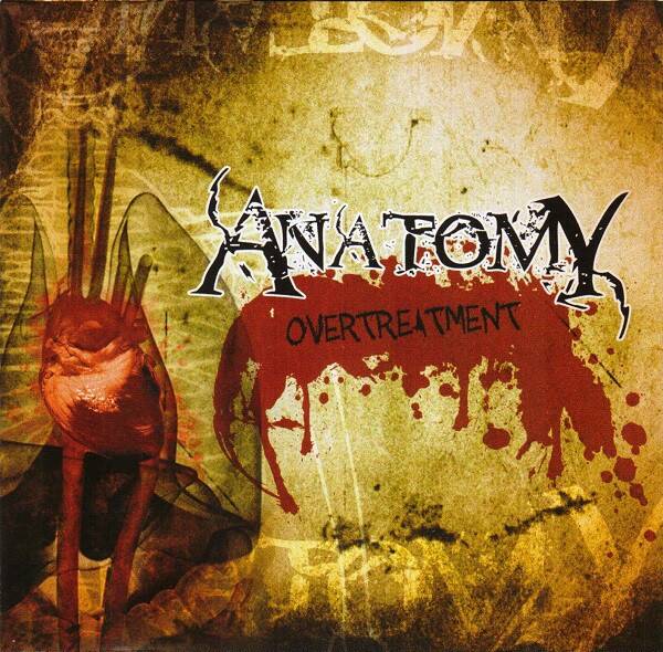 ANATOMY - Over Treatment CD