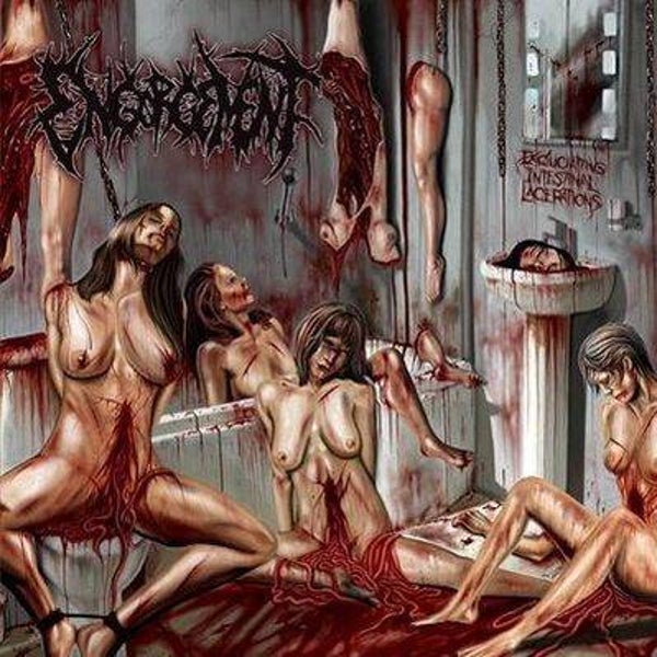 ENGORGEMENT - Excruciating Intestinal Lacerations CD