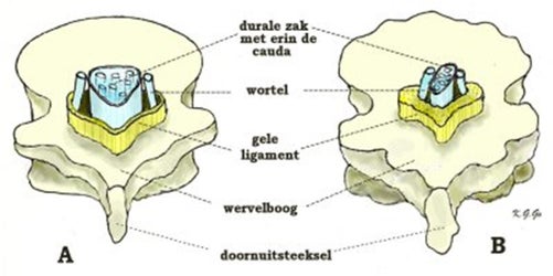 De Raadpleging Bij De Neurochirurg Lage Rugpijn GEZONDHEID deel 2 de-raadpleging-bij-de-neurochirurg-lage-rugpijn-gezondheid-deel-2