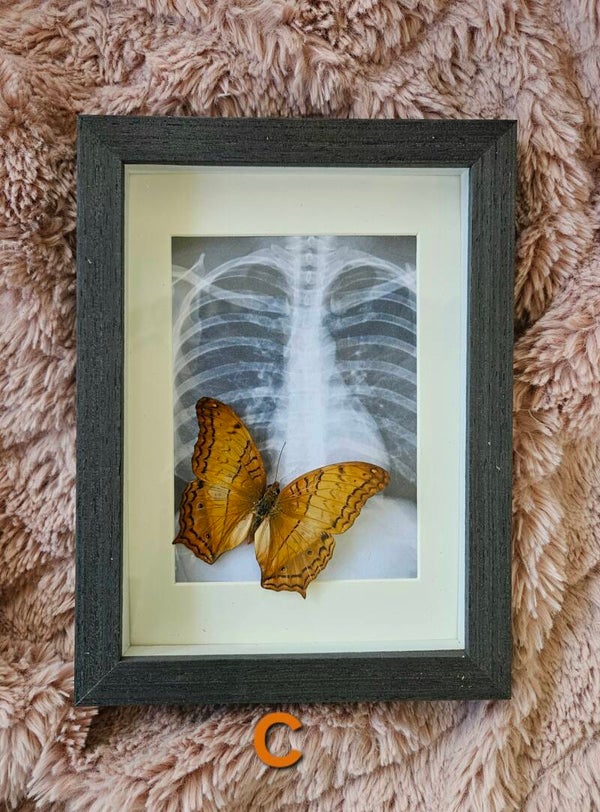 Butterflies in your tummy (real butterfly)