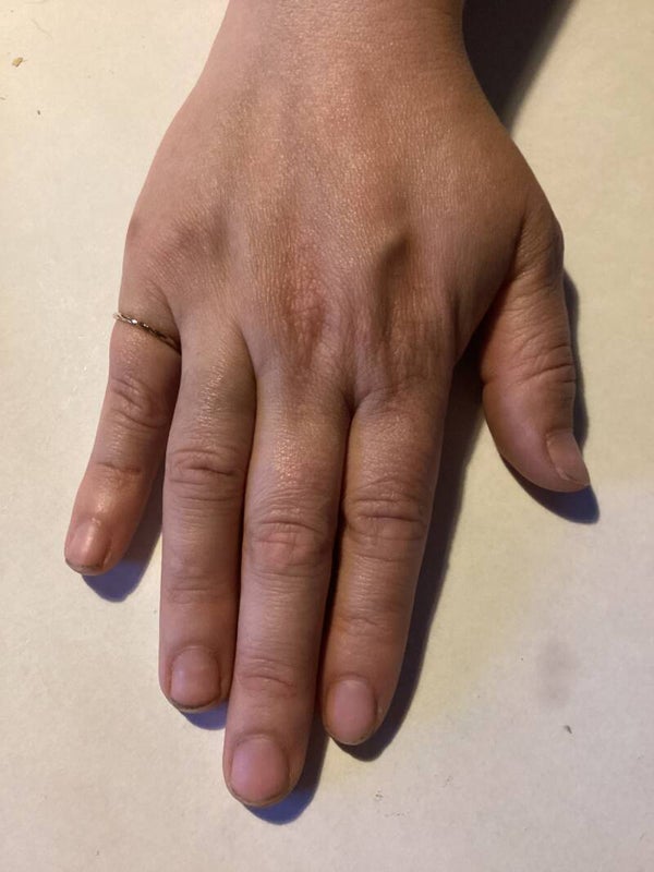 Ring 21