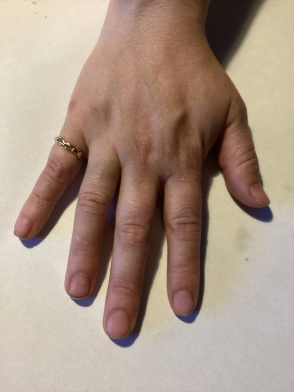 Ring 22