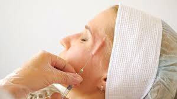 Brow, Temple and Piriform Fossa Filler