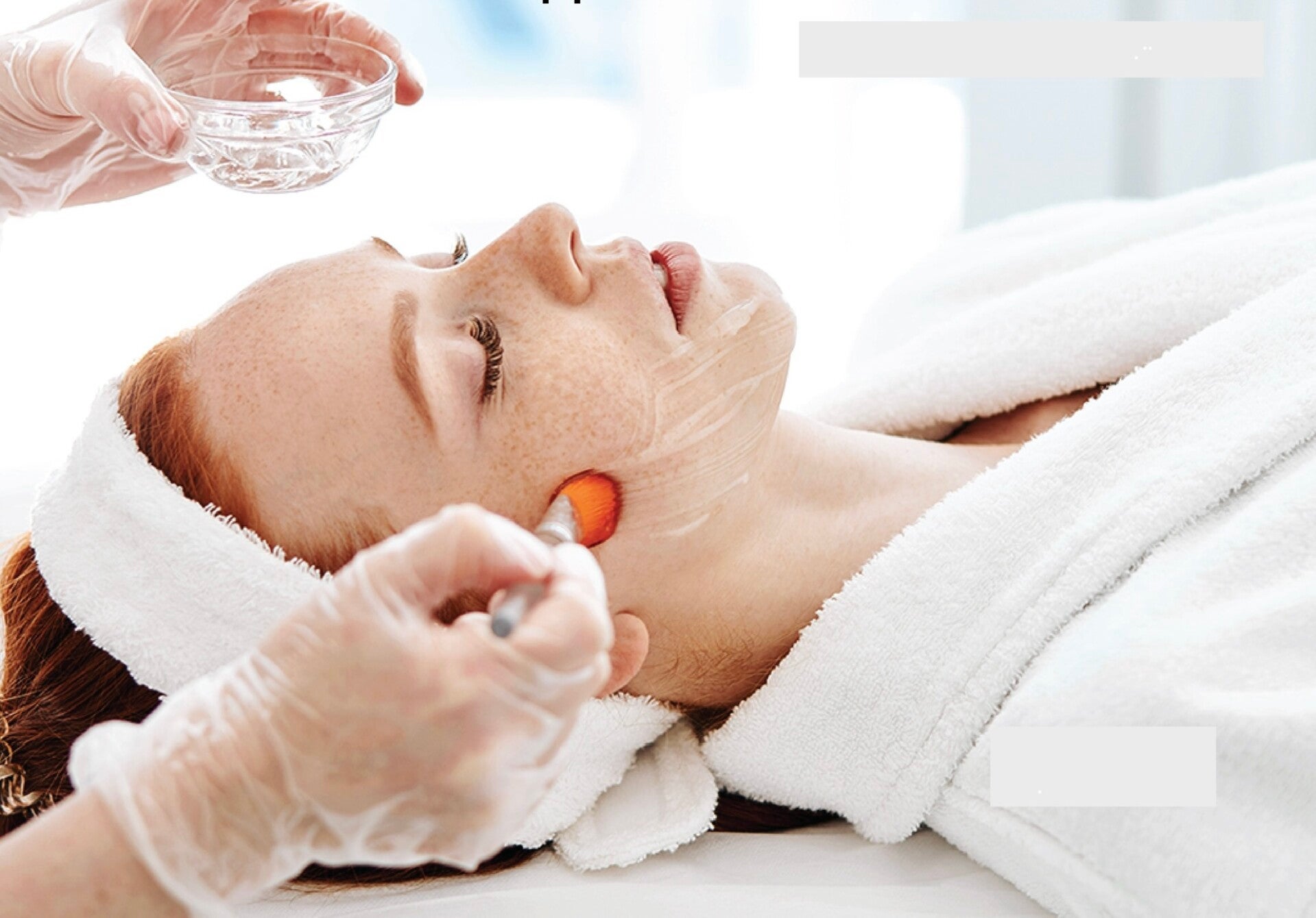 Chemical Peel