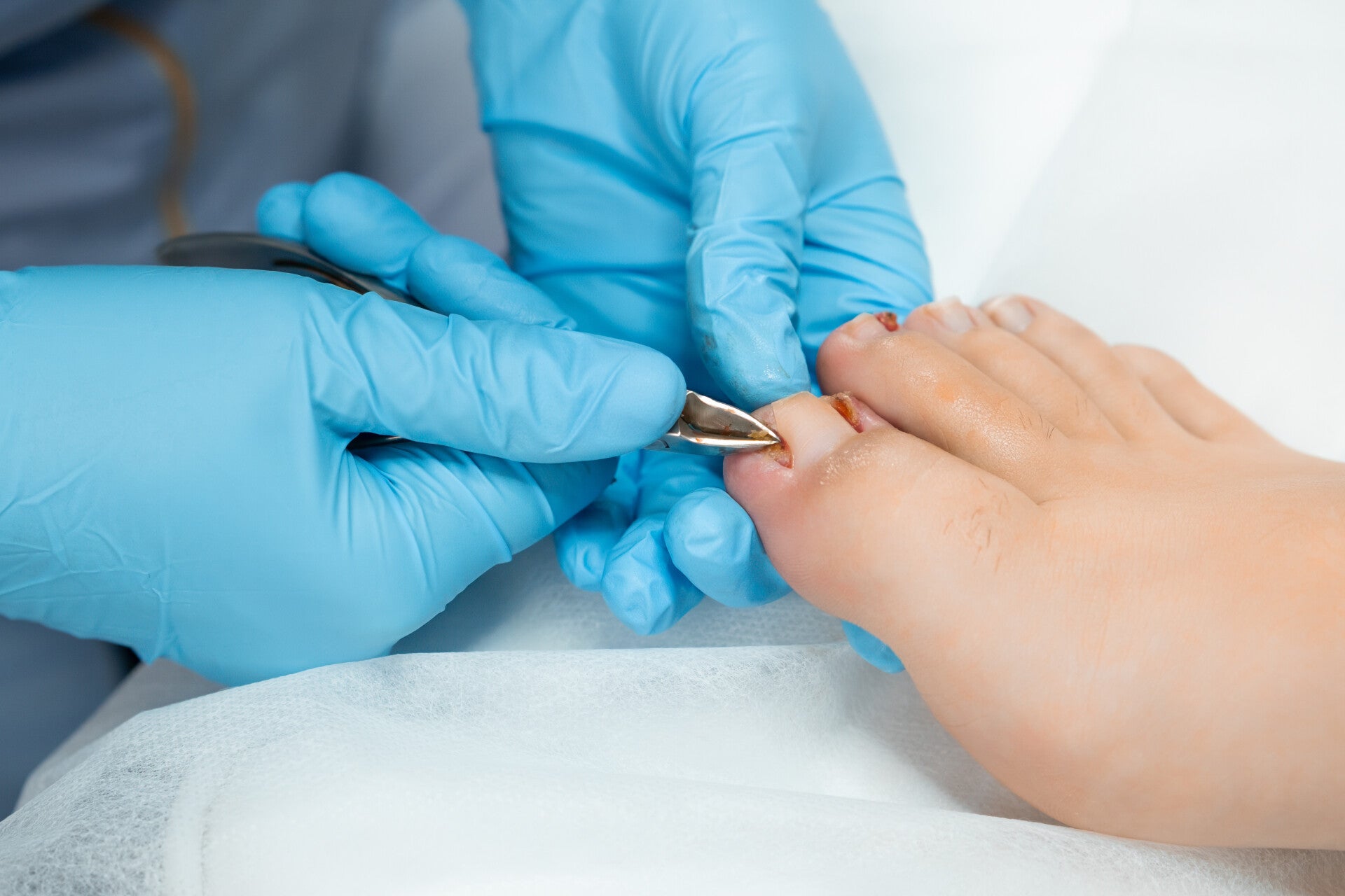Wendy Hines-Randle Nail Surgery