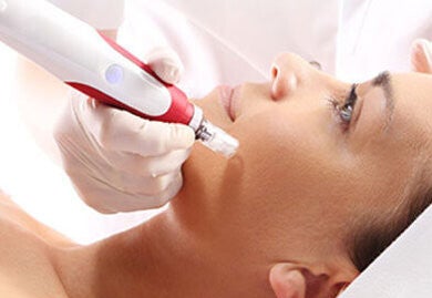 Microneedling Enzymatique et Dermaplanning