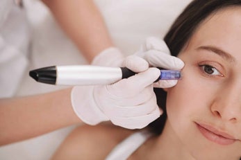 Microneedling Enzymatique