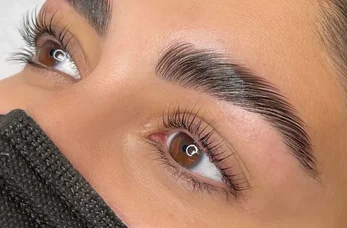 Brow Lift