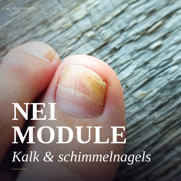 Kalk- & Schimmelnagels – De Verborgen Oorzaak Achter Hardnekkige Nagelproblemen