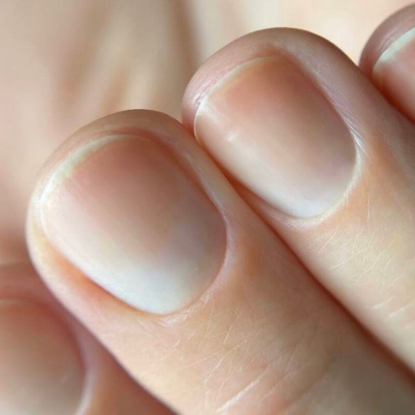 Natural Nail Knowledge - anatomie en pathologie theorieles (locatie: Zwolle)