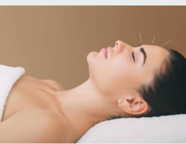 Bon cadeau acupuncture esthétique 1 séance bilan 60  min