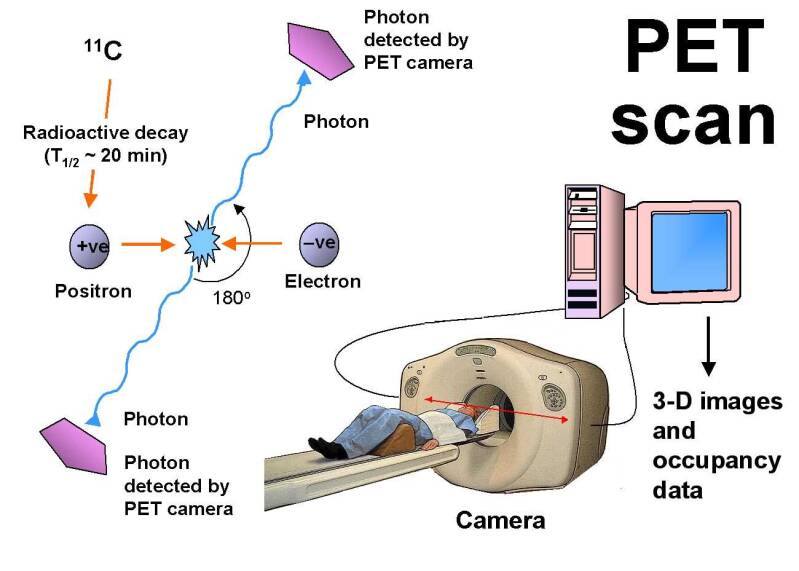 PET-scan. | natuurkundesite.nl