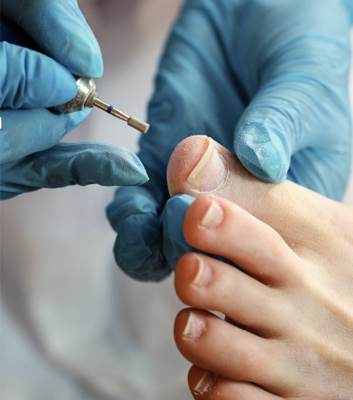 Pedicurebehandeling