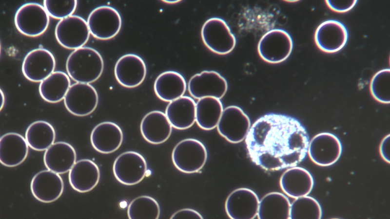 Duinkelfeld Aufnahme 1000 fache Vergrößerung