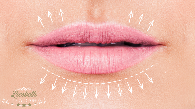 Ik wil vollere lippen