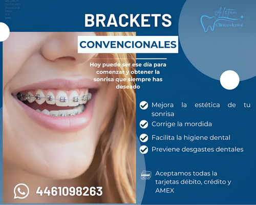 brakets-standard.png