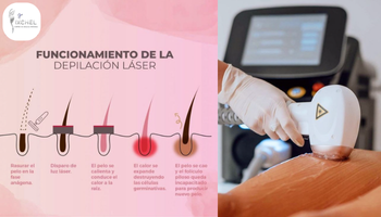 corporales-depilaci-n-laser-standard.png