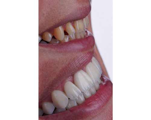 Diseño de Sonrisa