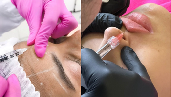 faciales-botox-acido-hialur-nico-standard.png