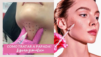 Lipopapada y Bichectomía Enzimática