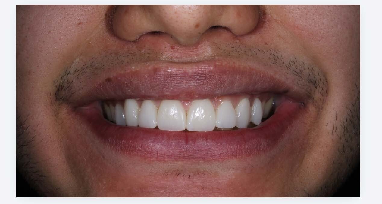 Odontología Restauradora - Caso 1