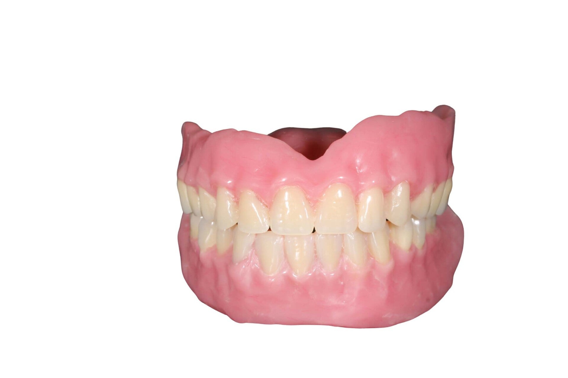Odontología Restauradora - Caso 2