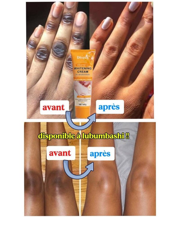 Crème de réparation Éclaircissante