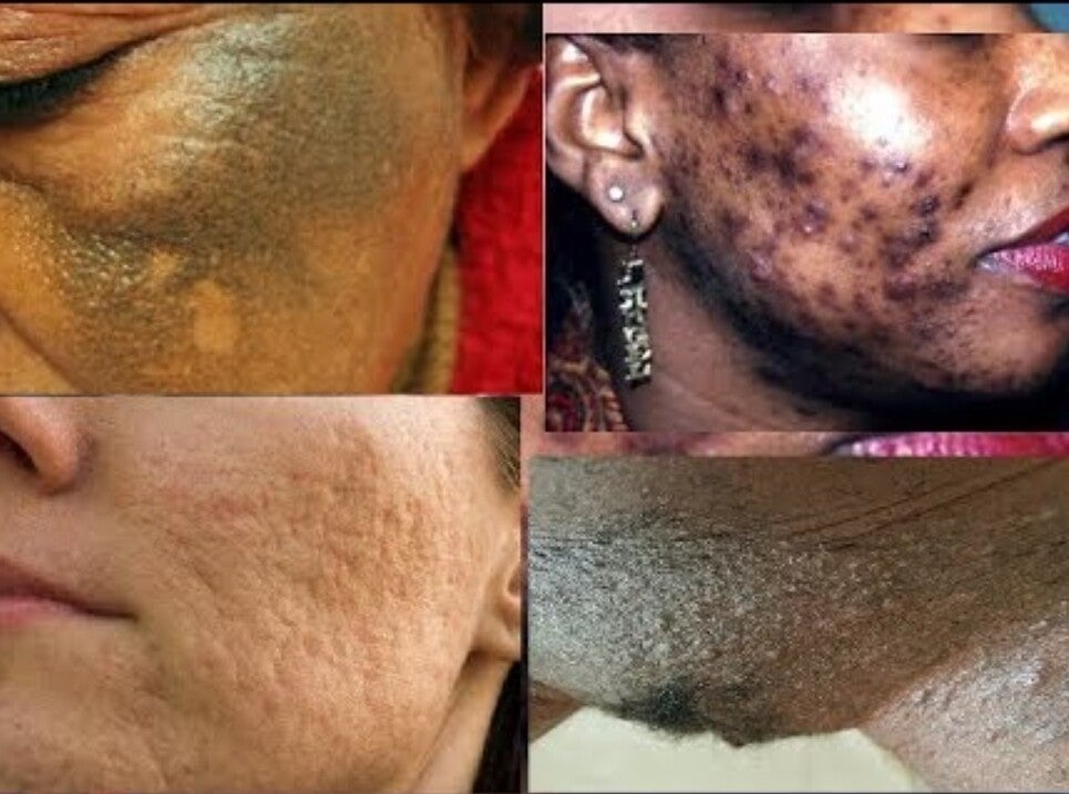 Lotion a la Vitamine C