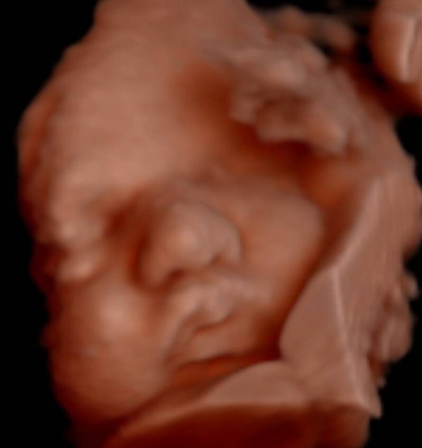 Cadeaubon - Before Birth Intense Journey