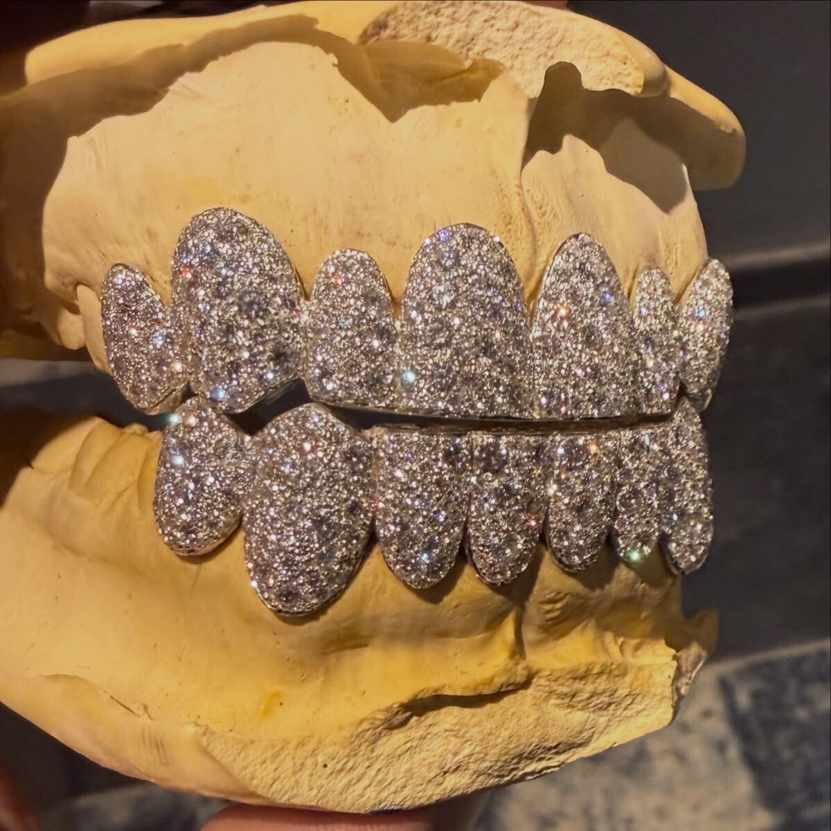 Diamond 8 on 8 Set